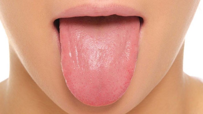 Защо да си почистваме езика?
