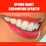 Сапфирени брекети